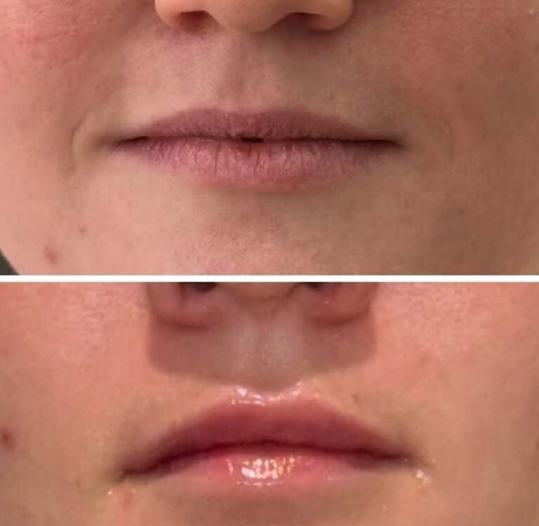 Core Aesthetics Oakleigh